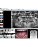 VisiQuick Røntgensoftware